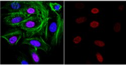 Thrombospondin-1 Mouse anti-Human, Rat, Clone: 133, MilliporeSigma 100
